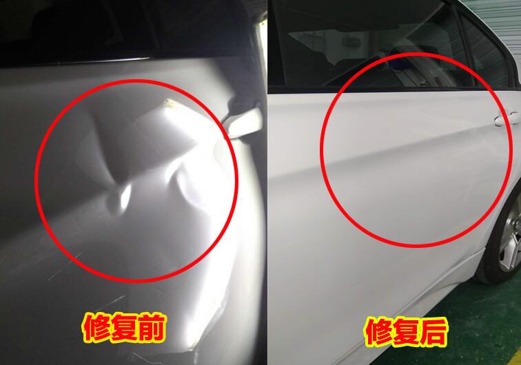 凹陷修复